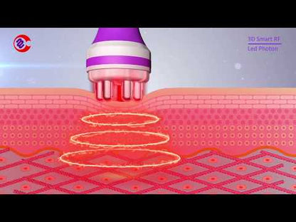 Radio Frequency Skin Tightening